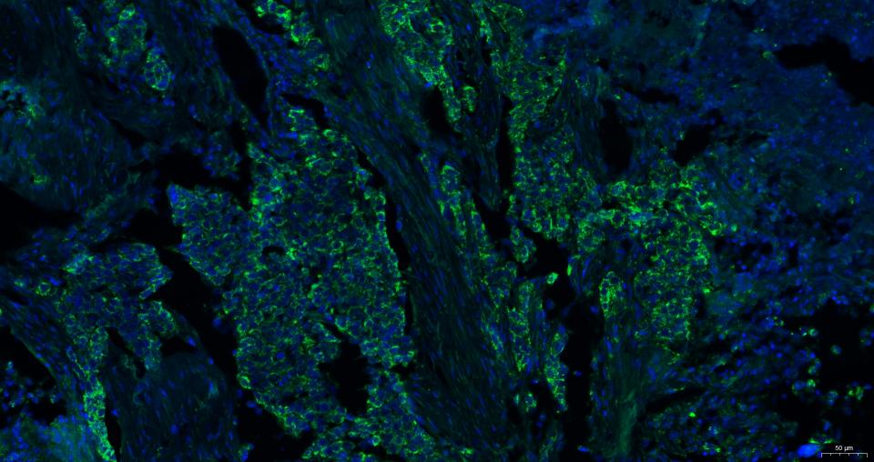 细胞表面趋化因子受体4抗体-bs-20317R