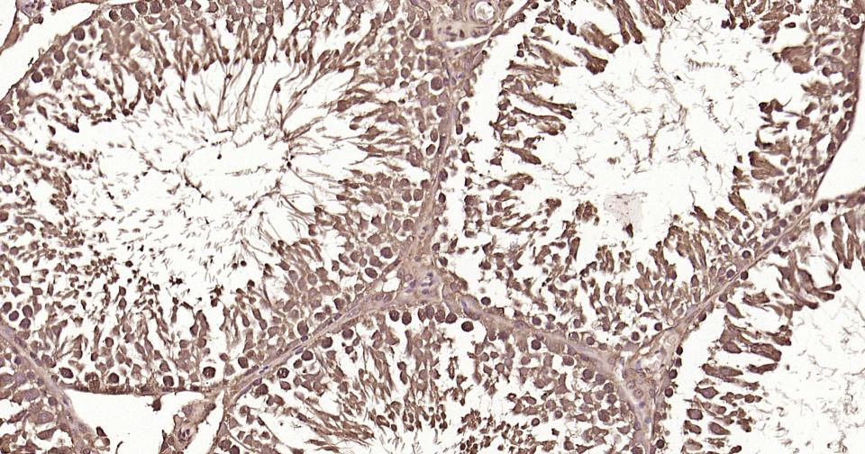 泛素蛋白重组兔单抗