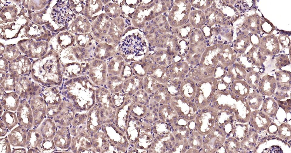 泛素蛋白（K63-linkage）重组兔单抗