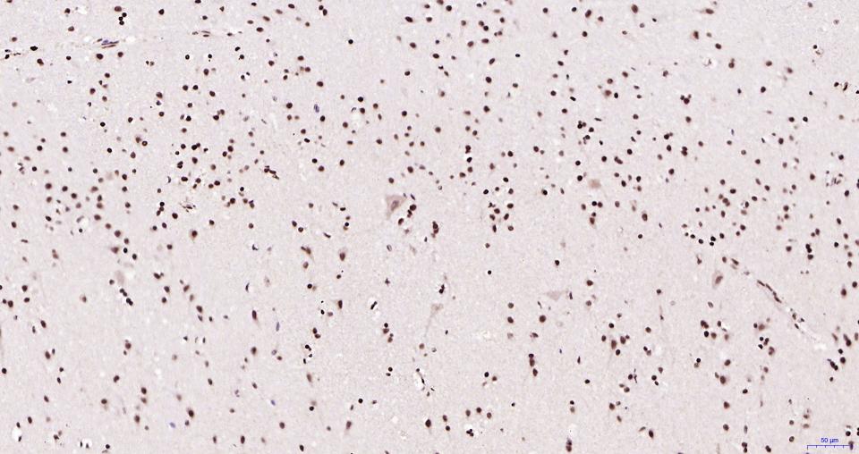 乙酰化组蛋白H3.1(Lys28)重组兔单抗