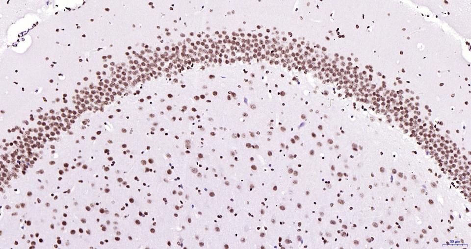 乙酰化组蛋白H3.1(Lys28)重组兔单抗