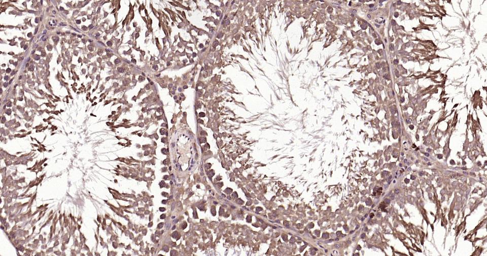 泛素蛋白（K63-linkage）重组兔单抗