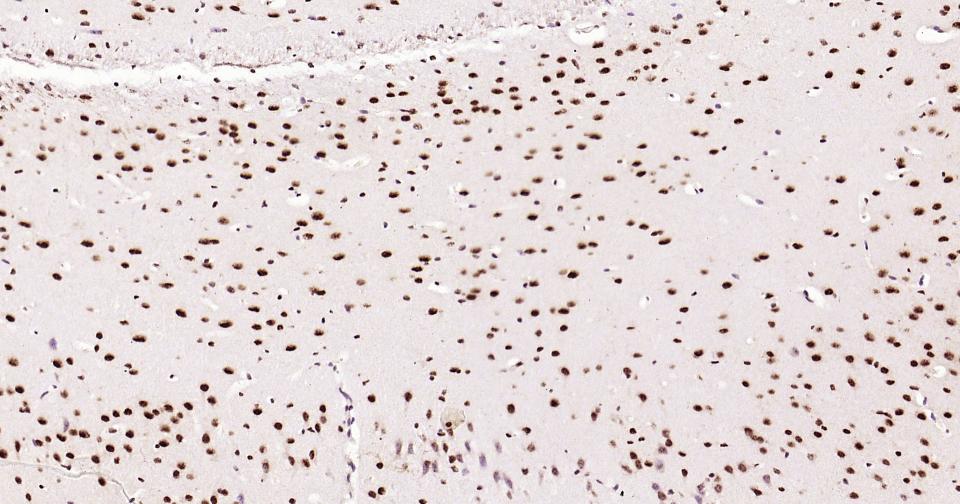 磷酸化CREB-1重组兔单抗