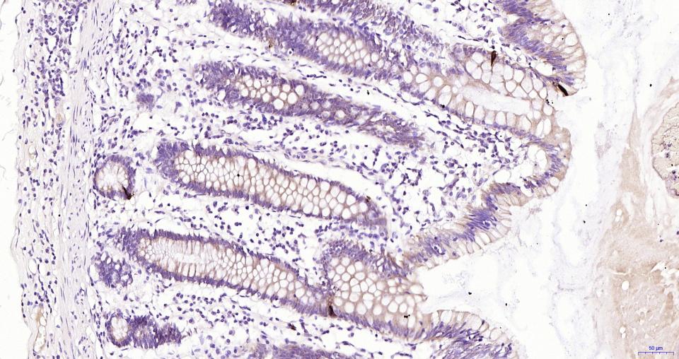 胰高血糖素重组兔单抗