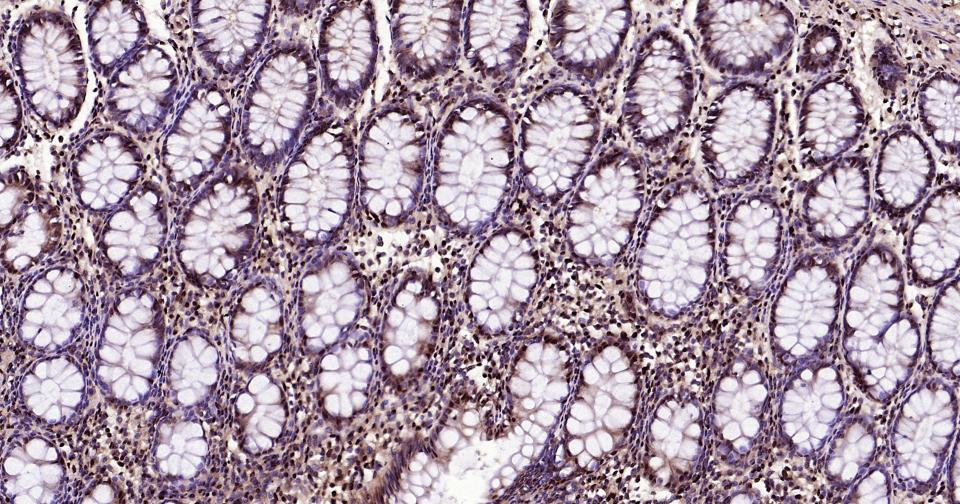 泛素蛋白（K27-linkage specific）重组兔单抗