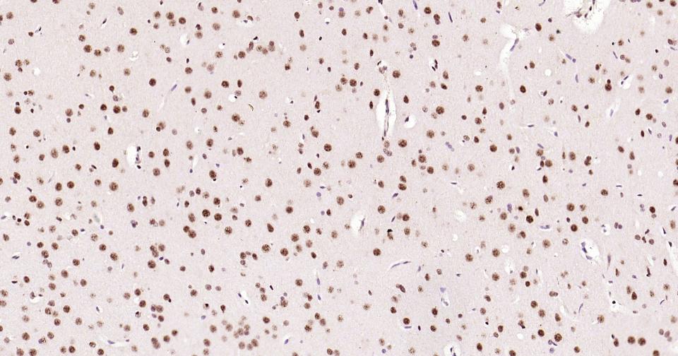 磷酸化CREB-1重组兔单抗