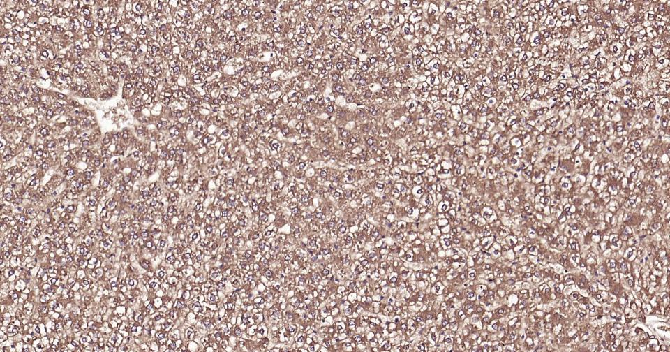 泛素蛋白（K63-linkage）重组兔单抗