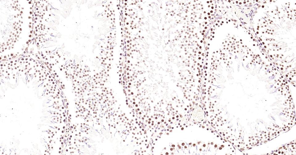 磷酸化CREB-1重组兔单抗