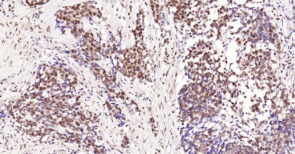 磷酸化CREB-1重组兔单抗
