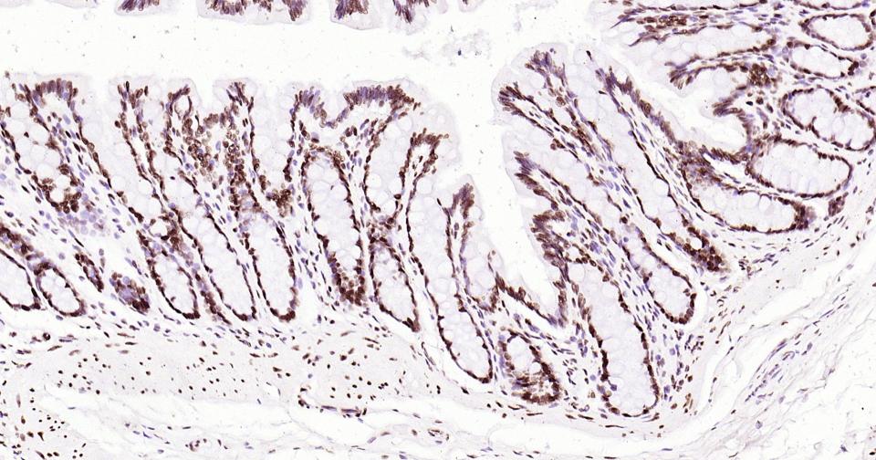 组蛋白H3(核内参)单克隆抗体-bsm-33042M