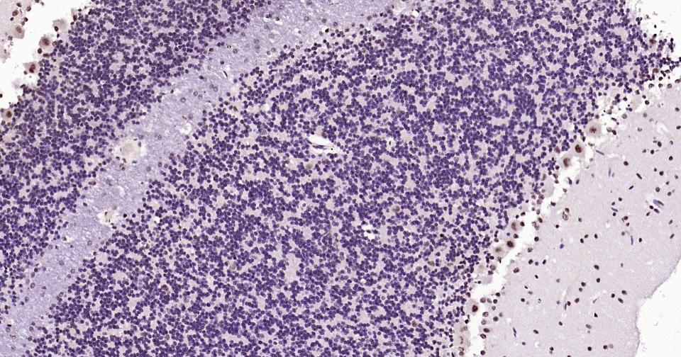 磷酸化CREB-1重组兔单抗