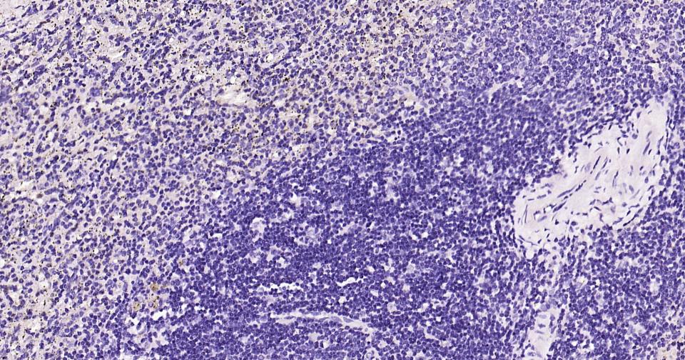 髓鞘碱性蛋白/磷脂碱性蛋白重组兔单抗