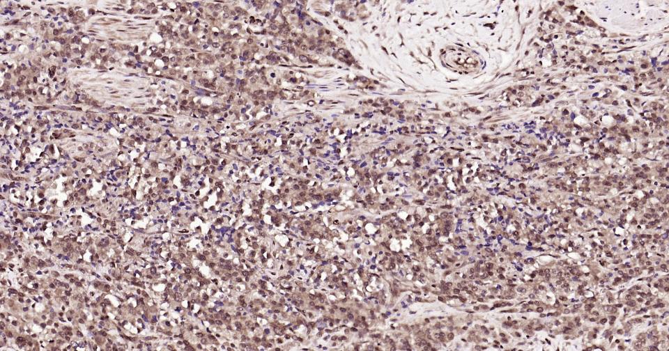 泛素蛋白（K27-linkage specific）重组兔单抗
