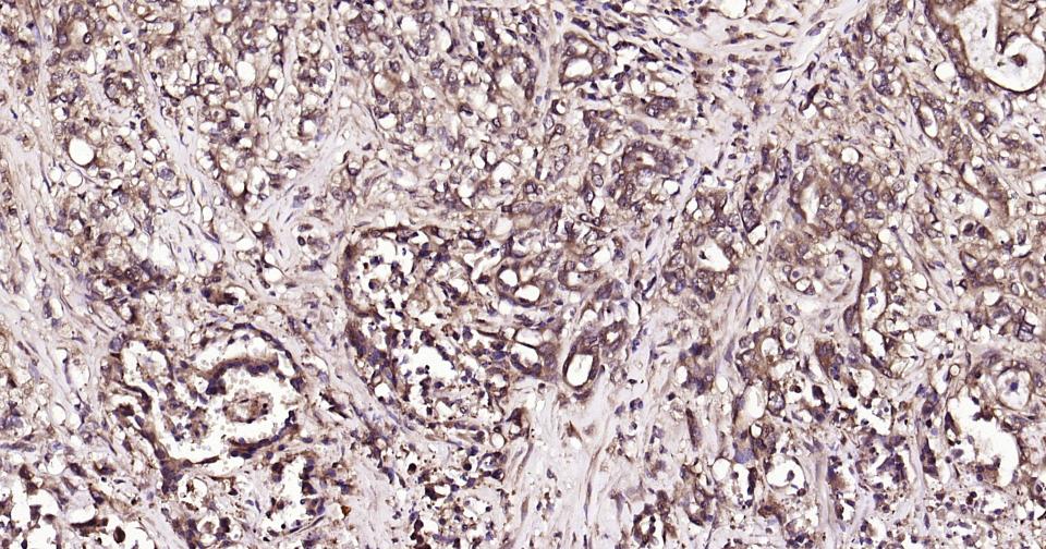 泛素蛋白（K63-linkage）重组兔单抗