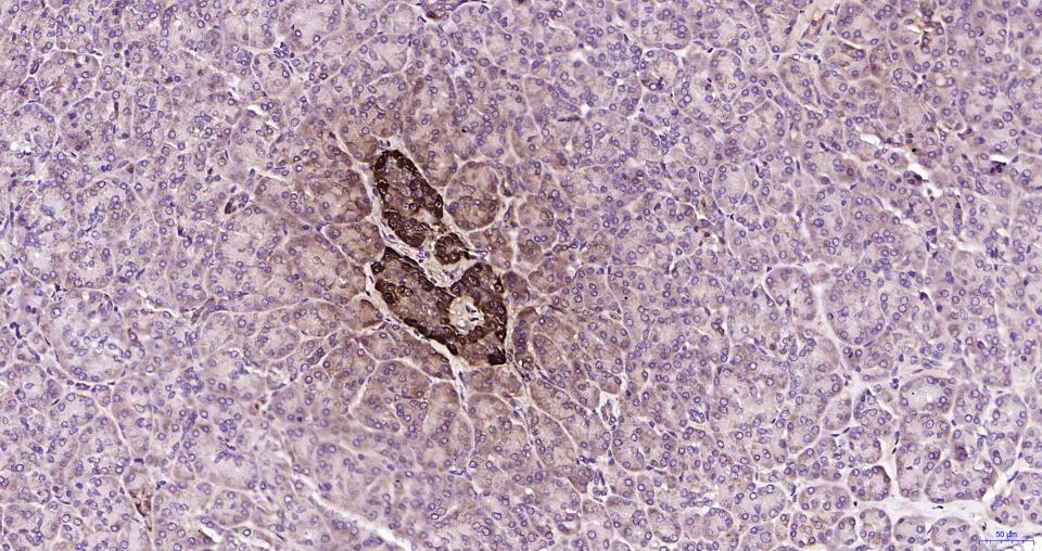 胰高血糖素重组兔单抗