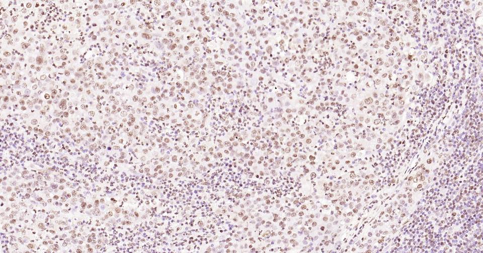 组蛋白H3(核内参)单克隆抗体-bsm-33042M