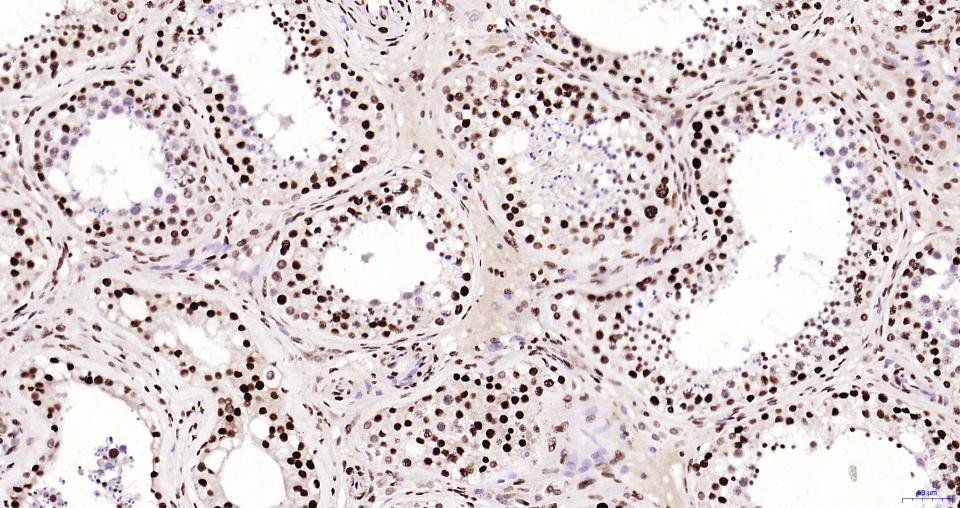 乙酰化组蛋白H3.1(Lys28)重组兔单抗