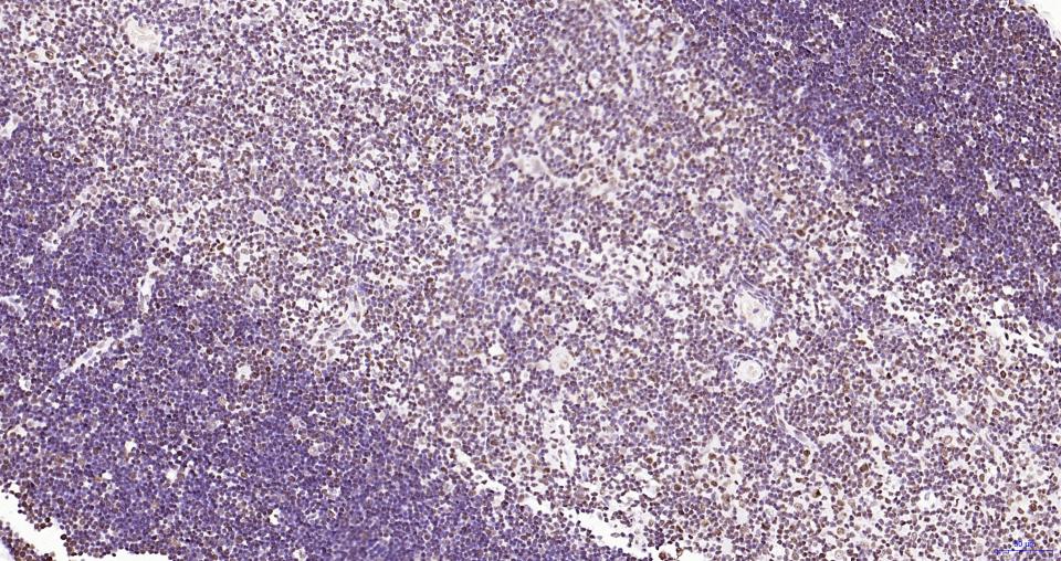 乙酰化组蛋白H3.1(Lys28)重组兔单抗