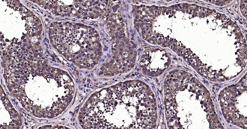 泛素蛋白（K63-linkage）重组兔单抗