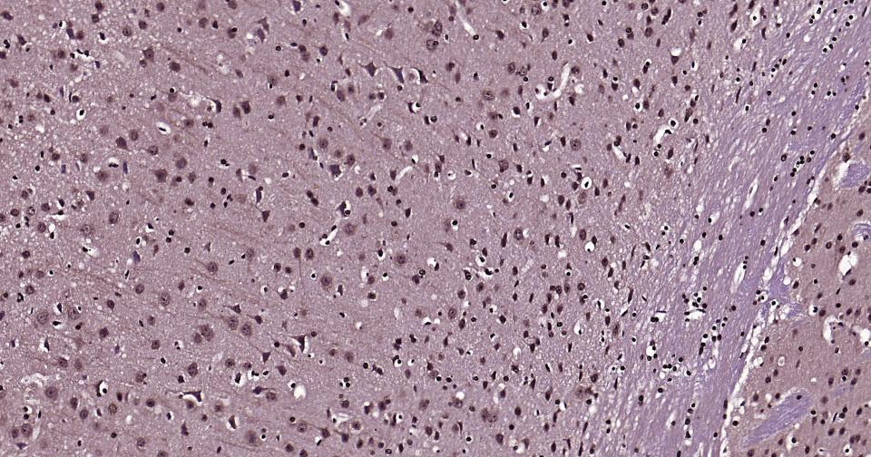 泛素蛋白（K27-linkage specific）重组兔单抗