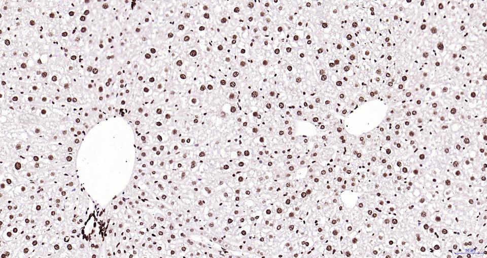 乙酰化组蛋白H3.1(Lys28)重组兔单抗