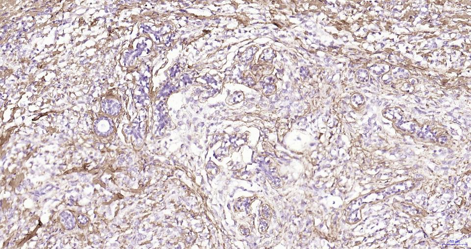 纤维连接蛋白重组兔单抗