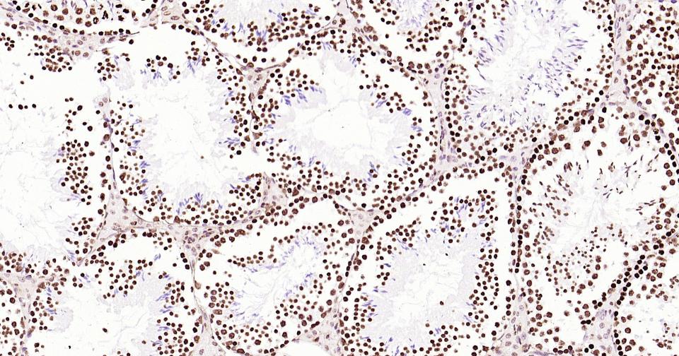 组蛋白H3(核内参)单克隆抗体-bsm-33042M