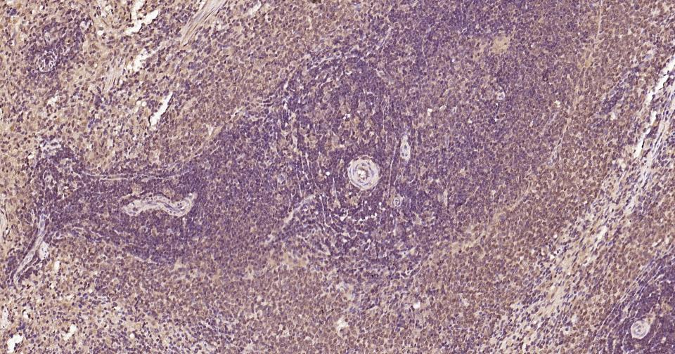 泛素蛋白(K48-linkage)重组兔单抗