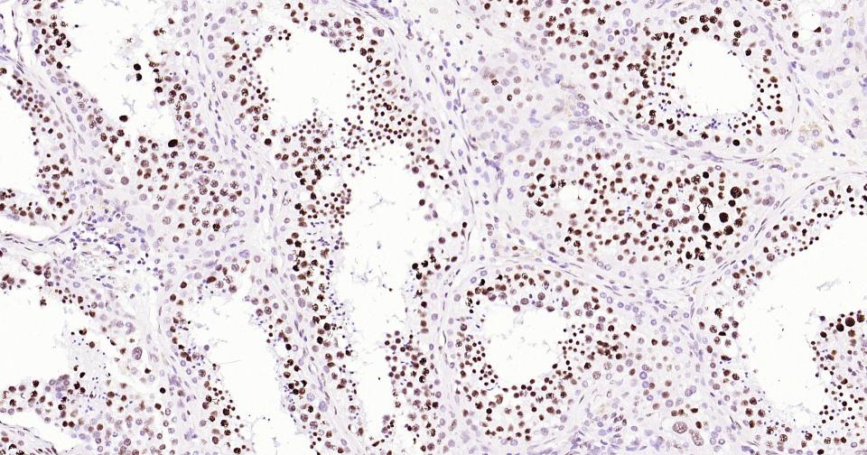 组蛋白H3(核内参)单克隆抗体-bsm-33042M