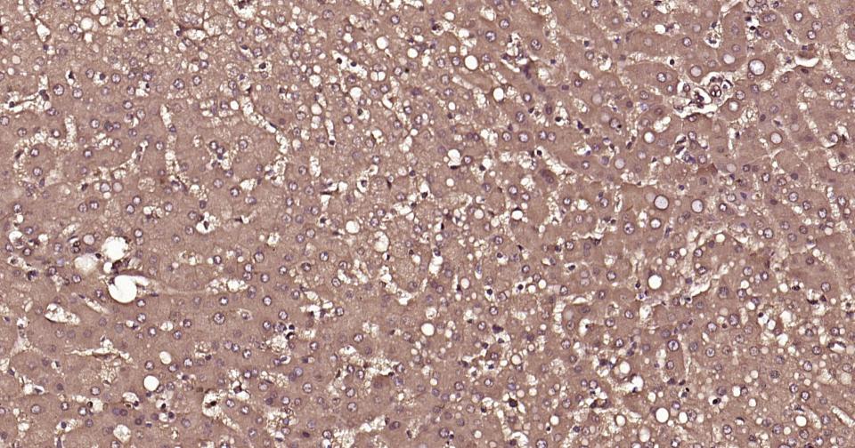 泛素蛋白重组兔单抗