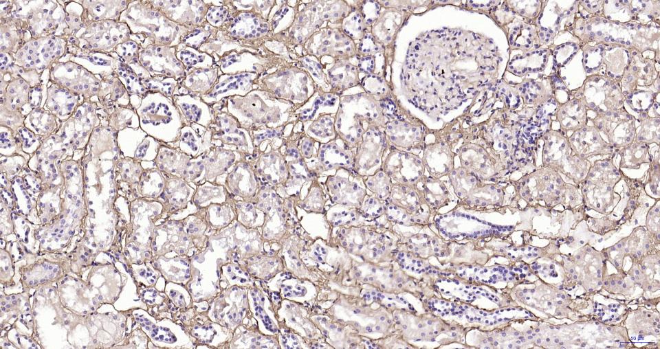 纤维连接蛋白重组兔单抗