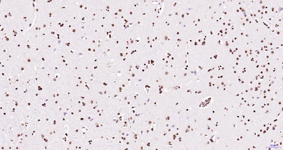 乙酰化组蛋白H3.1(Lys28)重组兔单抗