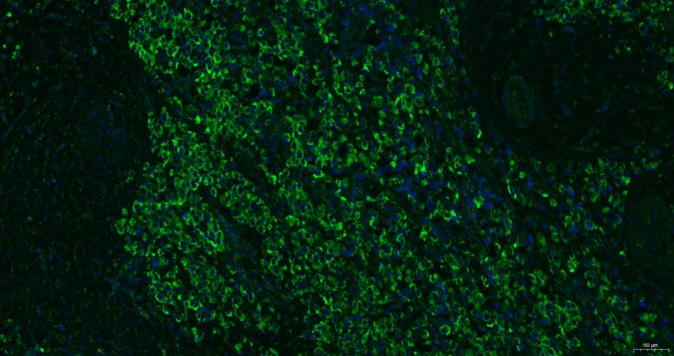 细胞表面趋化因子受体4抗体-bs-1011R