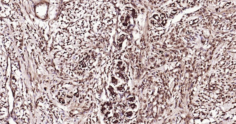 泛素蛋白（K27-linkage specific）重组兔单抗