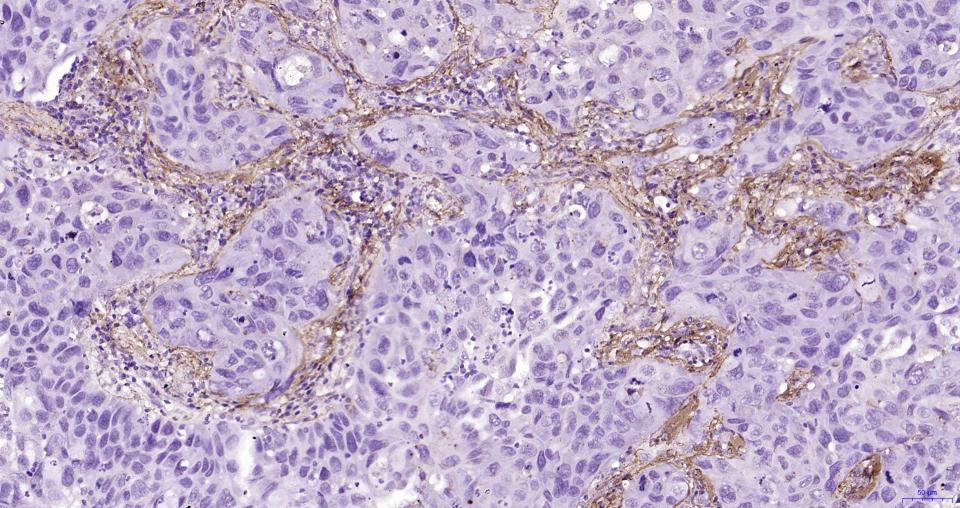 纤维连接蛋白重组兔单抗