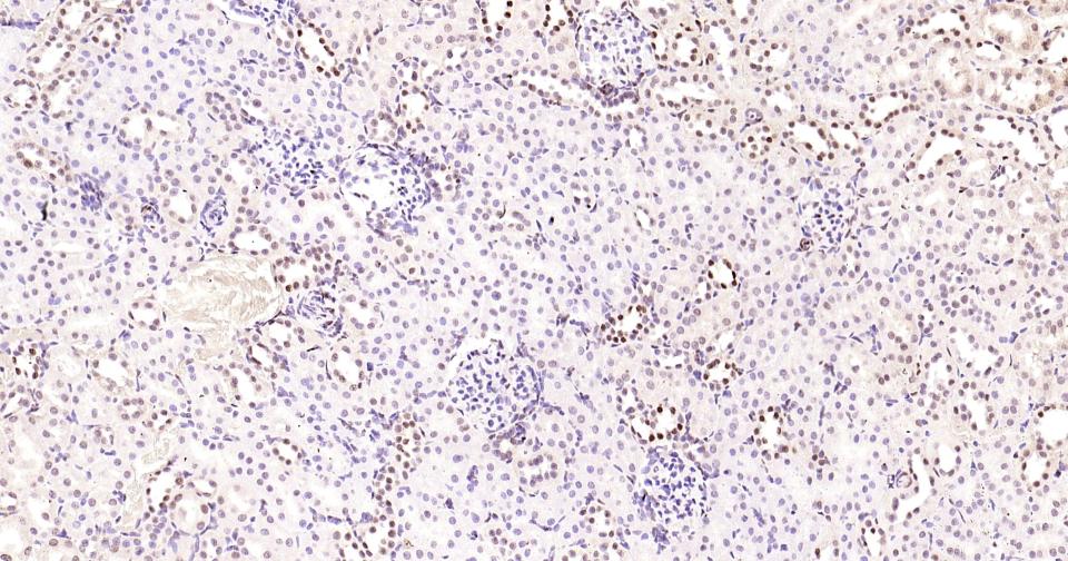 磷酸化CREB-1重组兔单抗