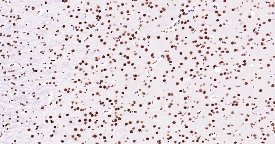 组蛋白H3(核内参)单克隆抗体-bsm-33042M