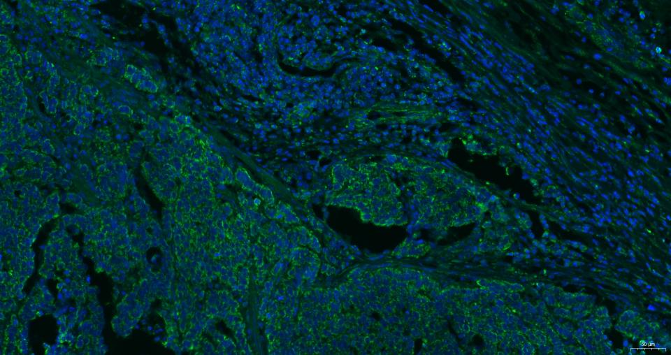 细胞表面趋化因子受体4抗体-bs-20317R