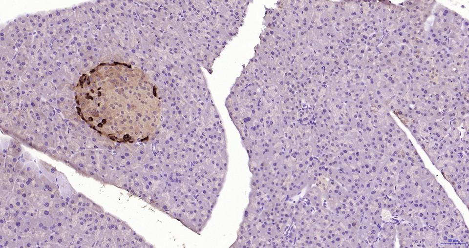 胰高血糖素重组兔单抗