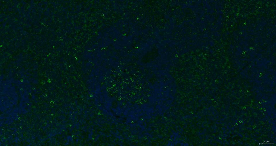 细胞表面趋化因子受体4抗体-bs-1011R