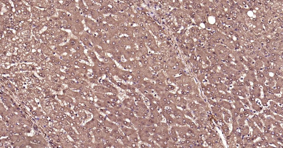 泛素蛋白（K63-linkage）重组兔单抗