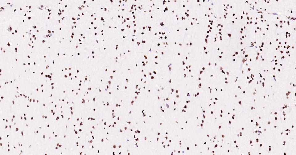 组蛋白H3(核内参)单克隆抗体-bsm-33042M