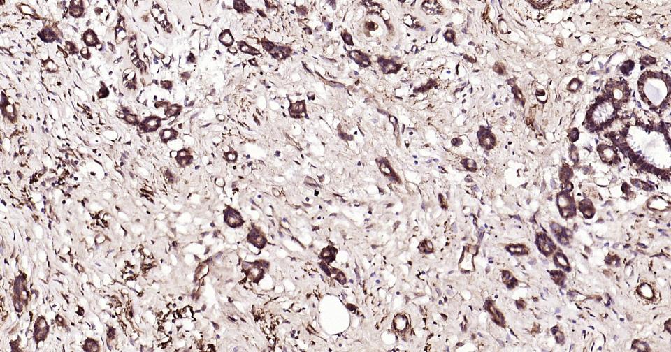 泛素蛋白（K63-linkage）重组兔单抗