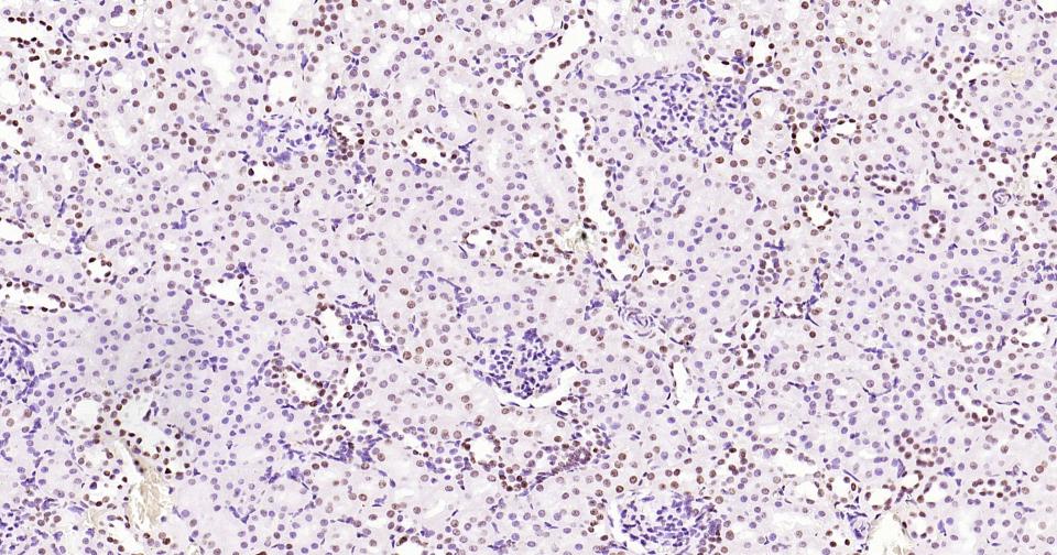 组蛋白H3(核内参)单克隆抗体-bsm-33042M