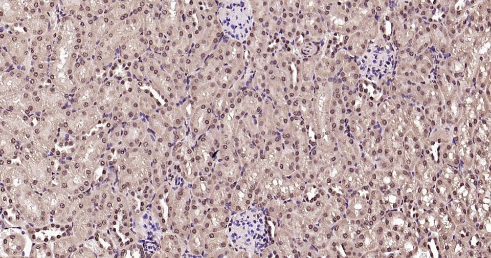 泛素蛋白（K27-linkage specific）重组兔单抗