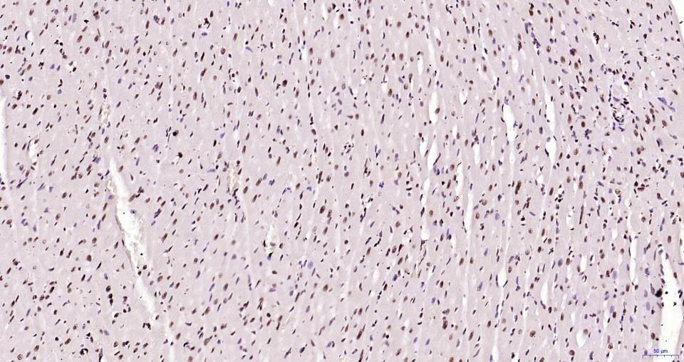 乙酰化组蛋白H3.1(Lys28)重组兔单抗