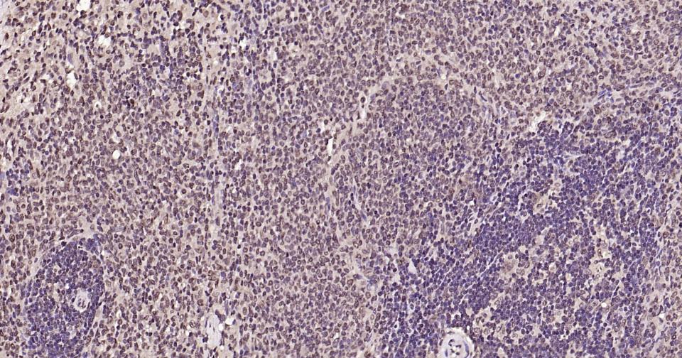 泛素蛋白（K27-linkage specific）重组兔单抗