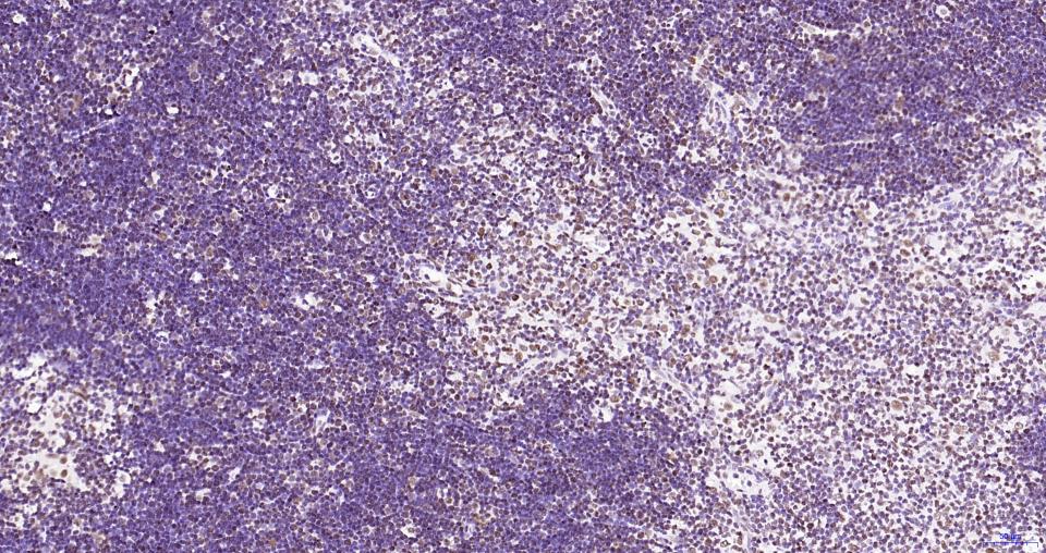 乙酰化组蛋白H3.1(Lys28)重组兔单抗