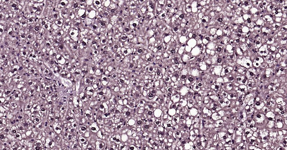 泛素蛋白（K27-linkage specific）重组兔单抗