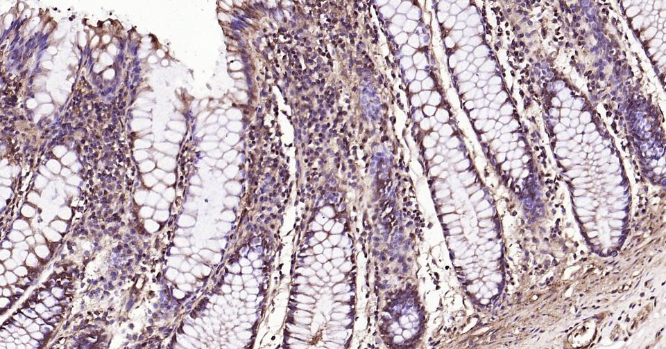 泛素蛋白（K63-linkage）重组兔单抗